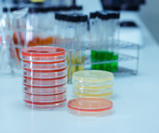 Cell Culture