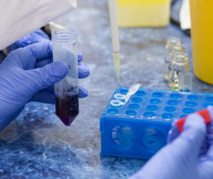 Chemical Analysis