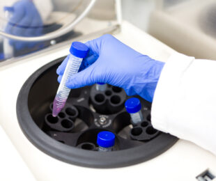 Sample Prep & Flow Cytometry