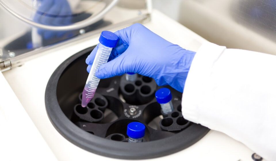 Sample Prep & Flow Cytometry