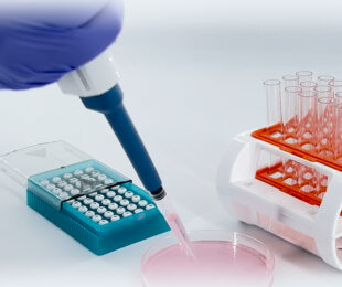Flow Cytometry